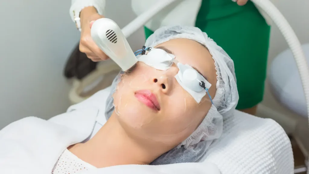 LASER TREATMENT