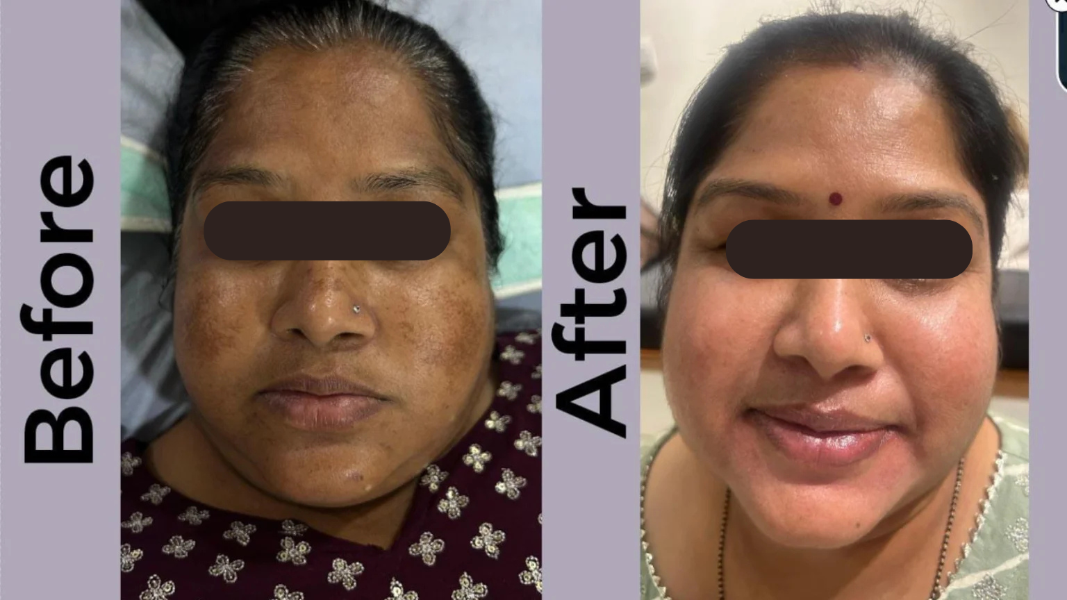 Before & After