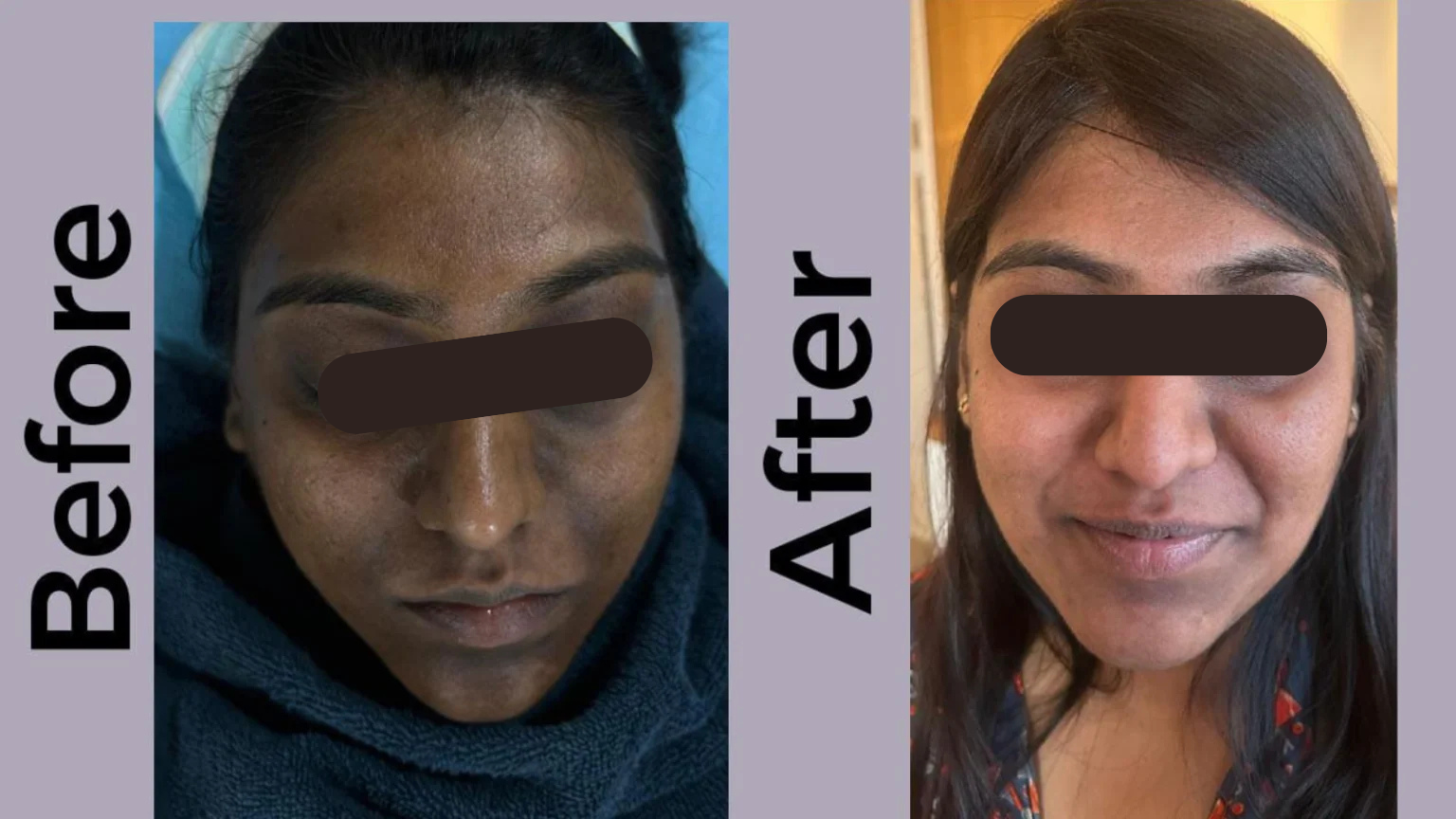 Before & After