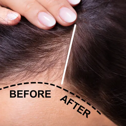 Hair Treatment
