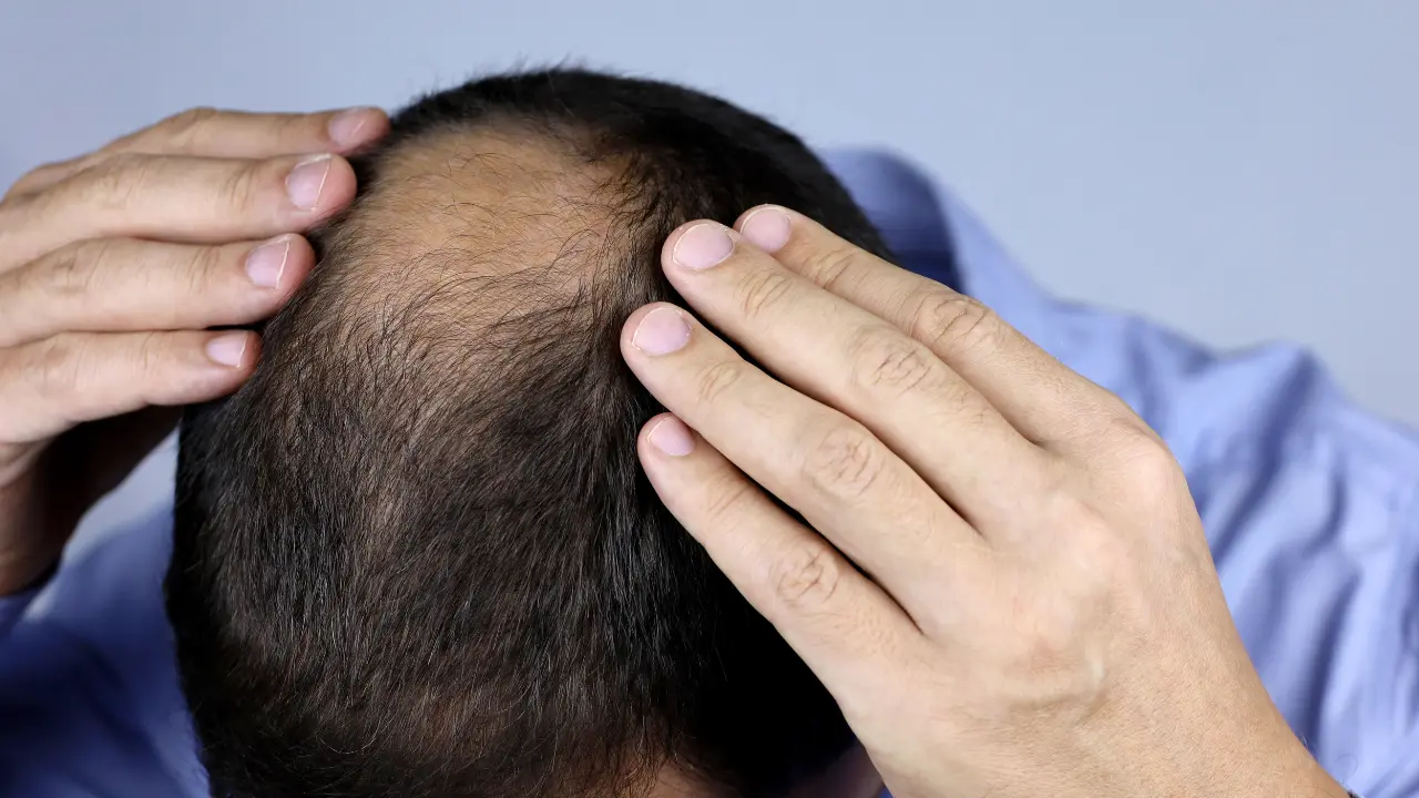 hair undri treatment