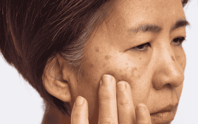 Reveal Even-Toned, Glowing, and Healthy Skin