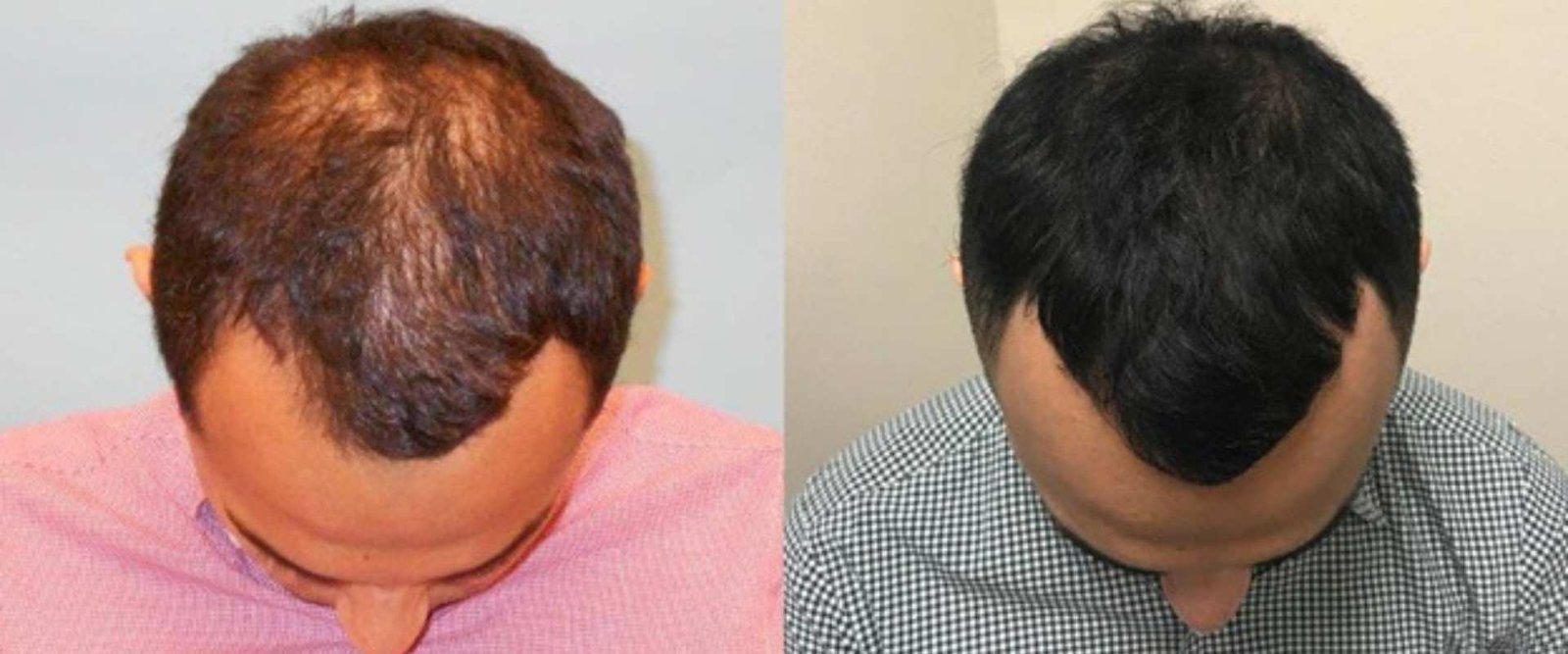 untitled design 2025 11 24t131343.540 drkrupa