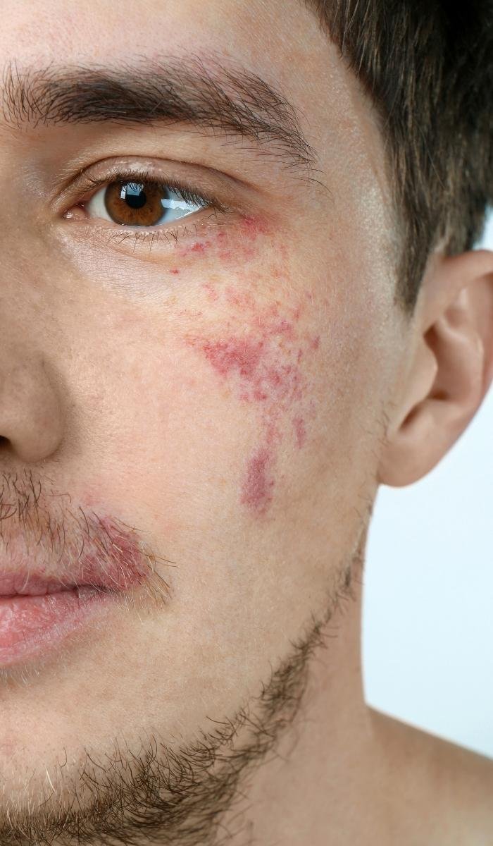 Reveal Even-Toned, Glowing, and Healthy Skin