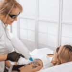 Tattoo Removal tattoo removal
