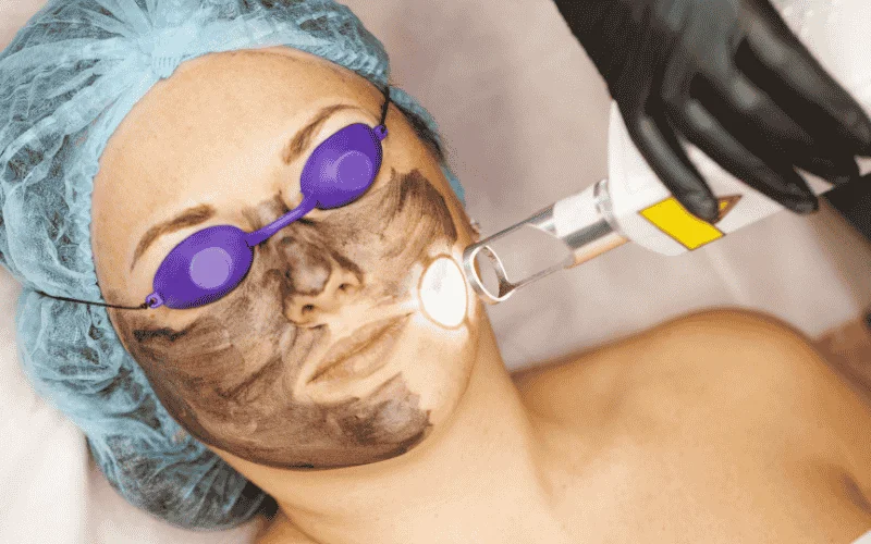 Laser Treatment