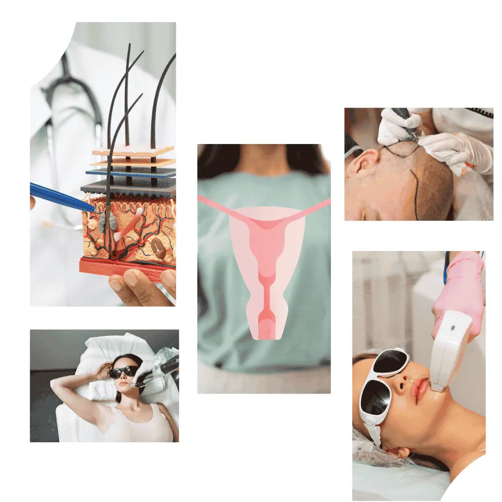 PCOD/PCOS Treatment Hair Transplant Laser Hair Removal