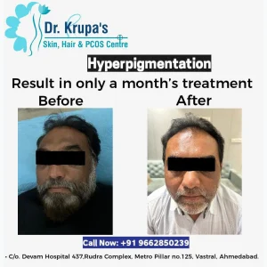 WhatsApp-Image-2025-01-20-at-15.05.58_d335aa45.webp Before & After