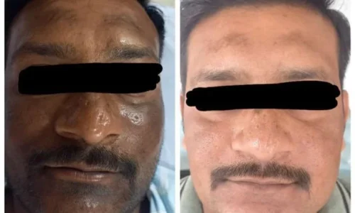 whatsapp image 2025 01 20 at 15.05.58 fe3a7401 1 1.webp